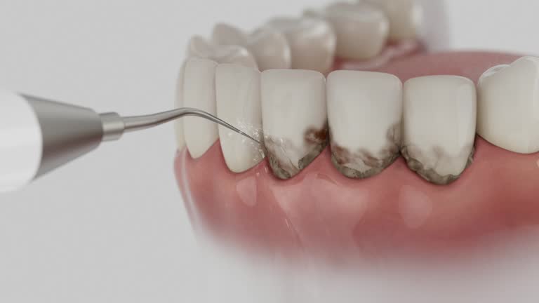 Reliable Tooth Extraction contractor in Murphys Estates, SC by Smile Center Dentistry